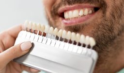 How Dental Veneers can Restore your Dental Structure