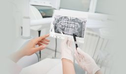 The Benefits of Digital Scanning: Faster, More Accurate, and Painless