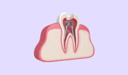 Can Root Canal Therapy Save Your Tooth and Relieve Pain?