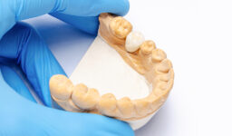 Factors to Think Of When Choosing a Dental Crown