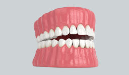 How Partials and Full Dentures Can Restore Your Smile and Confidence