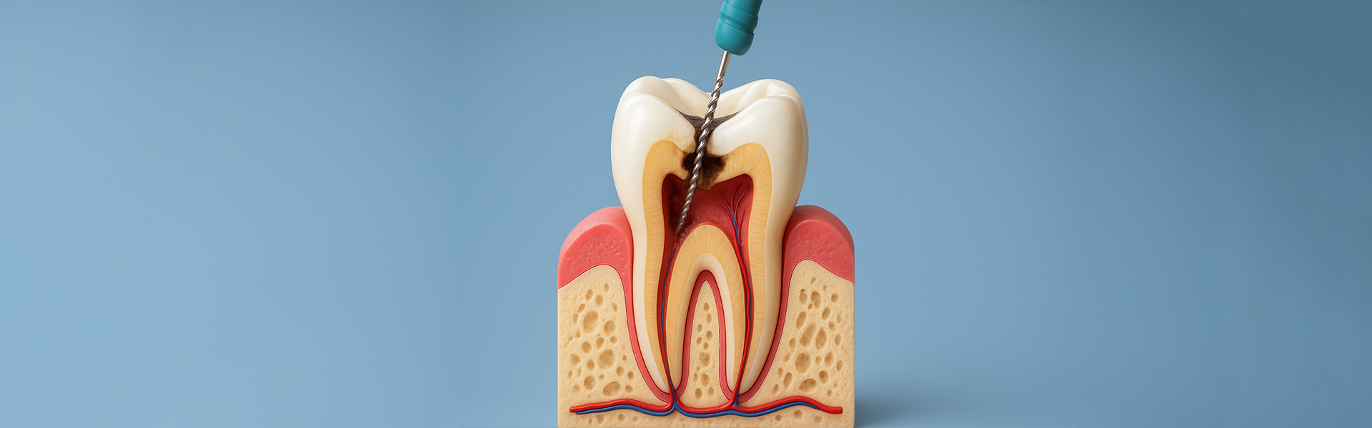 Is It Possible to Do a Root Canal Treatment in One Appointment?